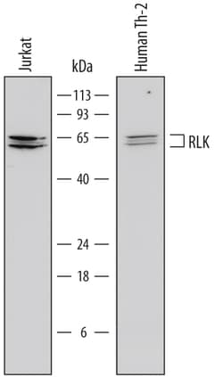 Human RLK/TXK Antibody, R D Systems 100ug; Unlabeled:Antibodies, Monoclonal