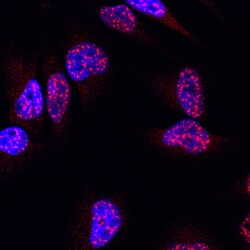 Human/Mouse RNF168 Antibody, R D Systems 100&mu;g; Unlabeled:Antibodies,