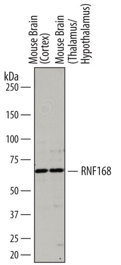 Human/Mouse RNF168 Antibody, R D Systems 100&mu;g; Unlabeled:Antibodies,