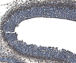 Rat ROBO1 Antibody, R D Systems 25&mu;g; Unlabeled:Antibodies, Polyclonal