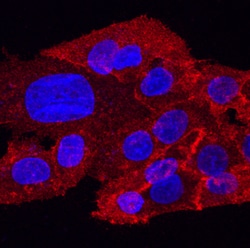 Human ROBO1 Antibody, R D Systems 25&mu;g; Unlabeled:Antibodies, Polyclonal