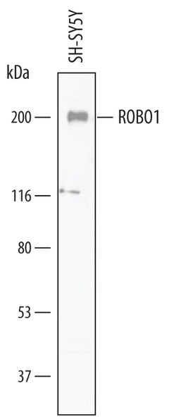 Human ROBO1 Antibody, R D Systems 25&mu;g; Unlabeled:Antibodies, Polyclonal