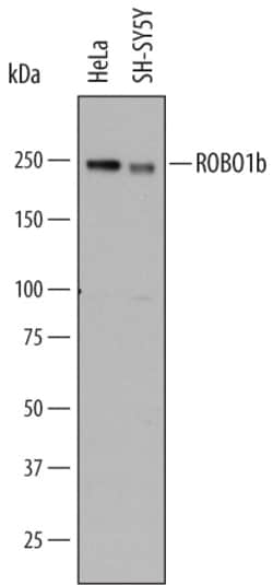 Human ROBO1 Antibody, R D Systems 25&mu;g; Unlabeled:Antibodies, Monoclonal