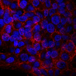 Human ROBO1 Antibody, R D Systems 100&mu;g; Unlabeled:Antibodies, Monoclonal