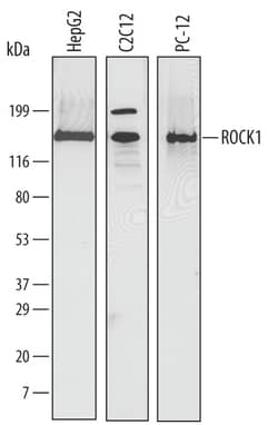 Human/Mouse/Rat ROCK1 Antibody, R D Systems 100ug; Unlabeled:Antibodies,