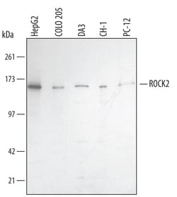 Human/Mouse/Rat ROCK2 Antibody, R D Systems 100&mu;g; Unlabeled:Antibodies,