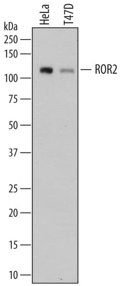 Human ROR2 Antibody, R D Systems 25&mu;g; Unlabeled:Antibodies, Polyclonal