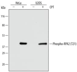 Human Phospho-RPA2 (T21) Antibody, R D Systems 25&mu;g; Unlabeled:Antibodies,
