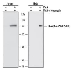 Human/Mouse/Rat Phospho-RSK1 (S380) Antibody, R D Systems 100 ug; Unconjugated:Antibodies,