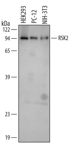 RSK2 Rabbit anti-Human, Mouse, Rat, Polyclonal, R D Systems 50&mu;g; Unlabeled:Antibodies,