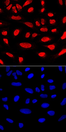 Human RUNX2/CBFA1 Antibody, R D Systems 25&mu;g; Unlabeled:Antibodies,