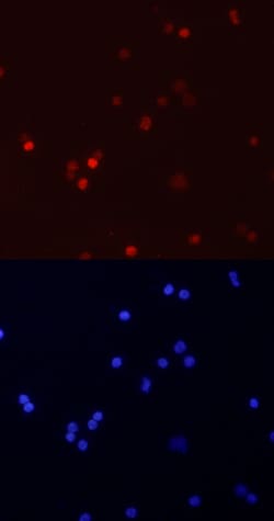 Human/Mouse RUNX3/CBFA3 Antibody, R D Systems 100ug; Unlabeled:Antibodies,