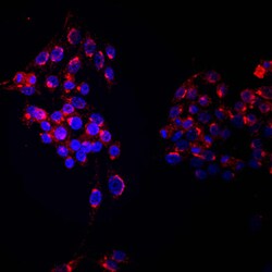Mouse Ryk Antibody, R D Systems 100&mu;g; Unlabeled:Antibodies, Polyclonal
