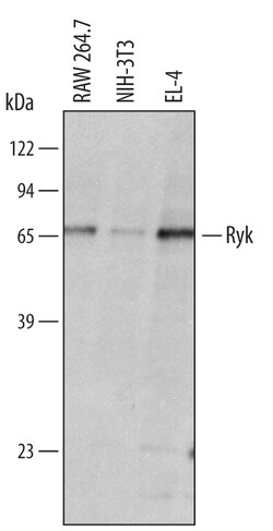 Mouse Ryk Antibody, R D Systems 100&mu;g; Unlabeled:Antibodies, Polyclonal