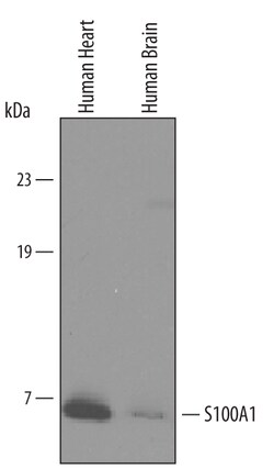Human S100A1 Antibody, R D Systems 25&mu;g; Unlabeled:Antibodies, Polyclonal
