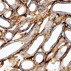 Mouse S100A10 Antibody, R D Systems 100&mu;g; Unlabeled:Antibodies, Polyclonal