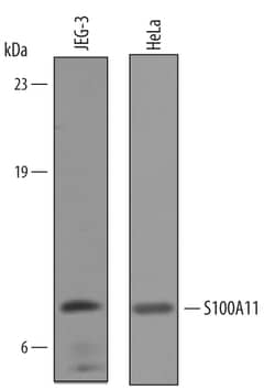 Human S100A11 Antibody, R D Systems 25&mu;g; Unlabeled:Antibodies, Polyclonal