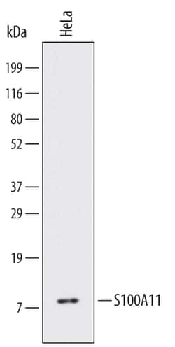 Human S100A11 Antibody, R D Systems 100ug; Unlabeled:Antibodies, Monoclonal