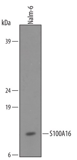 Human S100A16 Antibody, R D Systems 100&mu;g; Unlabeled:Antibodies, Polyclonal