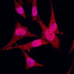 Human S100A2 Antibody, R D Systems 100&mu;g; Unlabeled:Antibodies, Polyclonal
