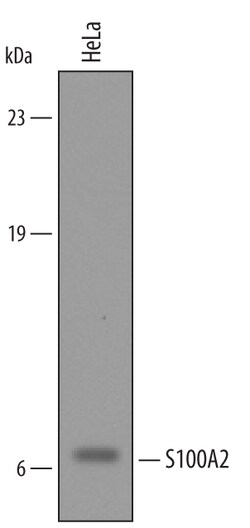 Human S100A2 Antibody, R D Systems 100&mu;g; Unlabeled:Antibodies, Polyclonal