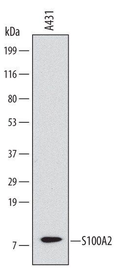 Human S100A2 Antibody, R D Systems 25&mu;g; Unlabeled:Antibodies, Monoclonal