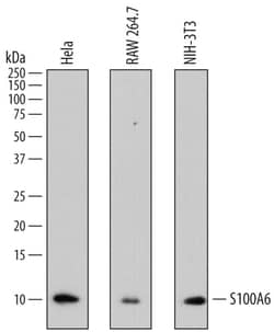Human S100A6 Antibody, R D Systems 25&mu;g; Unlabeled:Antibodies, Monoclonal