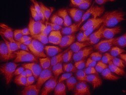 Mouse S100A8 Antibody, R D Systems 100&mu;g; Unlabeled:Antibodies, Polyclonal