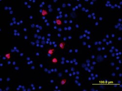 Mouse S100A8 Antibody, R D Systems 100&mu;g; Unlabeled:Antibodies, Polyclonal
