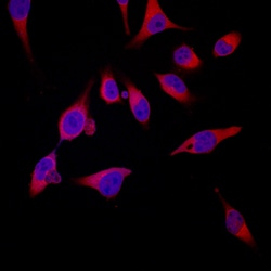 Human S100A8 Antibody, R D Systems 100&mu;g; Unlabeled:Antibodies, Polyclonal