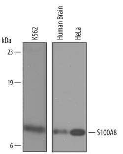 Human S100A8 Antibody, R D Systems 100&mu;g; Unlabeled:Antibodies, Polyclonal