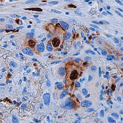 Human S100A8 Antibody, R D Systems 100ug; Unlabeled:Antibodies, Monoclonal