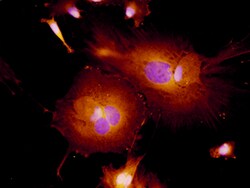 Mouse S100A9 Antibody, R D Systems 100&mu;g; Unlabeled:Antibodies, Polyclonal
