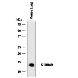 Mouse S100A9 Antibody, R D Systems 100&mu;g; Unlabeled:Antibodies, Polyclonal