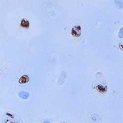 Human S100A9 Antibody, R D Systems 25&mu;g; Unlabeled:Antibodies, Polyclonal