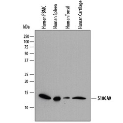 Human S100A9 Antibody, R D Systems 25&mu;g; Unlabeled:Antibodies, Polyclonal