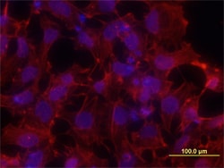 Human S100P Antibody, R D Systems 25&mu;g; Unlabeled:Antibodies, Monoclonal