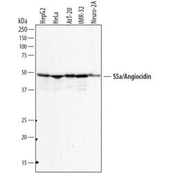 Human/Mouse S5a/Angiocidin Antibody, R D Systems 25&mu;g; Unlabeled:Antibodies,