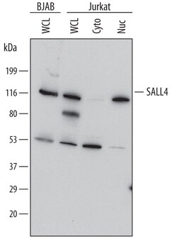 Human/Mouse SALL4 Antibody, R D Systems 100ug; Unlabeled:Antibodies, Monoclonal