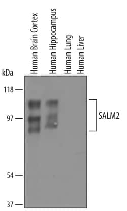 Human SALM2/LRFN1 Antibody, R D Systems 25&mu;g; Unlabeled:Antibodies,