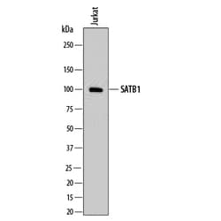 Human/Mouse SATB1 Antibody, R D Systems 100ug; Unlabeled:Antibodies, Monoclonal