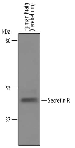 Human Secretin R Antibody, R D Systems 100&mu;g; Unlabeled:Antibodies,