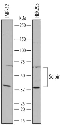 Human Seipin/BSCL2 Antibody, R D Systems 25 &mu;g | Buy Online | R&D Systems | Fisher Scientific