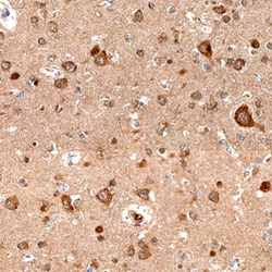 Human Semaphorin 4C Antibody, R D Systems 100&mu;g; Unlabeled:Antibodies,