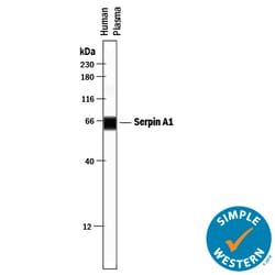 Human Serpin A1/alpha 1-Antitrypsin Antibody, R D Systems 25&mu;g; Unlabeled:Antibodies,