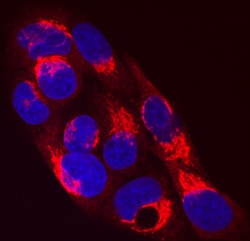 Human Serpin A1/alpha 1-Antitrypsin Antibody, R D Systems 25&mu;g; Unlabeled:Antibodies,