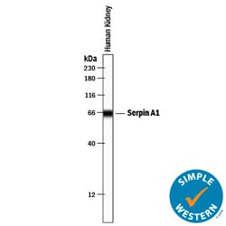 Human Serpin A1/alpha 1-Antitrypsin Antibody, R D Systems 25&mu;g; Unlabeled:Antibodies,