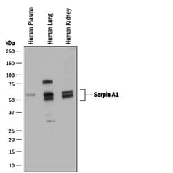 Human Serpin A1/alpha 1-Antitrypsin Antibody, R D Systems 25&mu;g; Unlabeled:Antibodies,