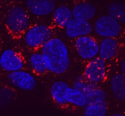 Human Serpin A1/alpha 1-Antitrypsin Antibody, R D Systems:Antibodies:Primary