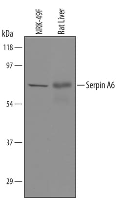 Rat Serpin A6 Antibody, R D Systems 25&mu;g; Unlabeled:Antibodies, Polyclonal